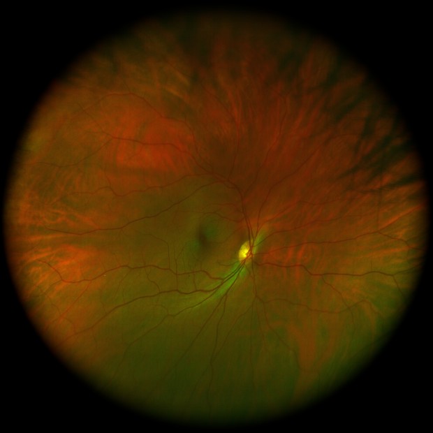 Look Into My World (x-ray of my Left Eye)